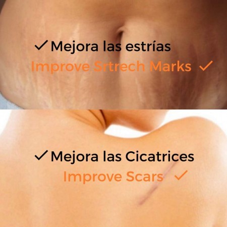 ACEITE DE ROSA MOSQUETA RF 30 ML