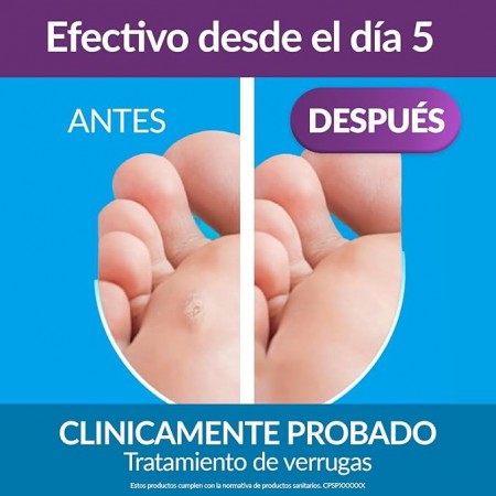 EXCILOR WARTS DUO POWER TRATAMIENTO ANTI VERRUGAS  10 ML