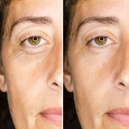 CAMALEON MAGIC SERUM AMPOLLA FLASH CONTORNO DE OJOS 1 VIAL 2 ML