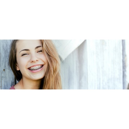 ORTOLACER COLUTORIO SABOR LIMA FRESCA 500ML