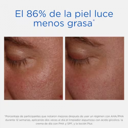 NEOSTRATA RESURFACE LOCION FORTE 200 ML