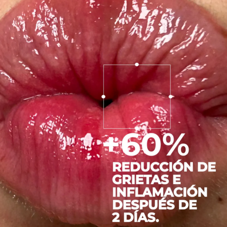 SEGLE REPAIR LIP BALM VOLUME & FILLER TOFFEE KISS BALSAMO LABIAL CON COLOR 10ML