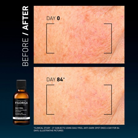 FILORGA DAILY PEEL SOLUCION RENOVADORA ANTIMANCHAS 50ML