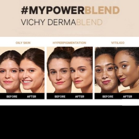 VICHY DERMABLEND FONDO DE MAQUILLAJE CORRECTOR GOLD 45 30 ML