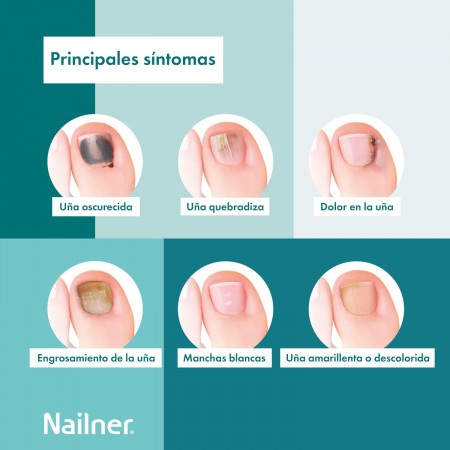 PACK NAILNER LAPIZ ANTIHONGOS UÑAS 2EN1 4ML + REGALO NAILNER ULTIMATE FORTALECEDOR 10ML