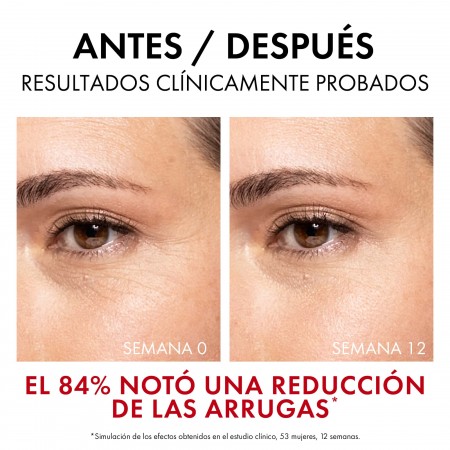 Antes y después tras 12 semanas de tratamiento con el sérum de colágeno Vichy