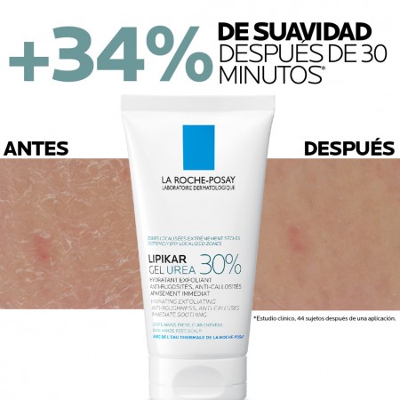Resultados inmediatos en suavidad de la piel con el tratamiento Lipikar Gel Urea 30%